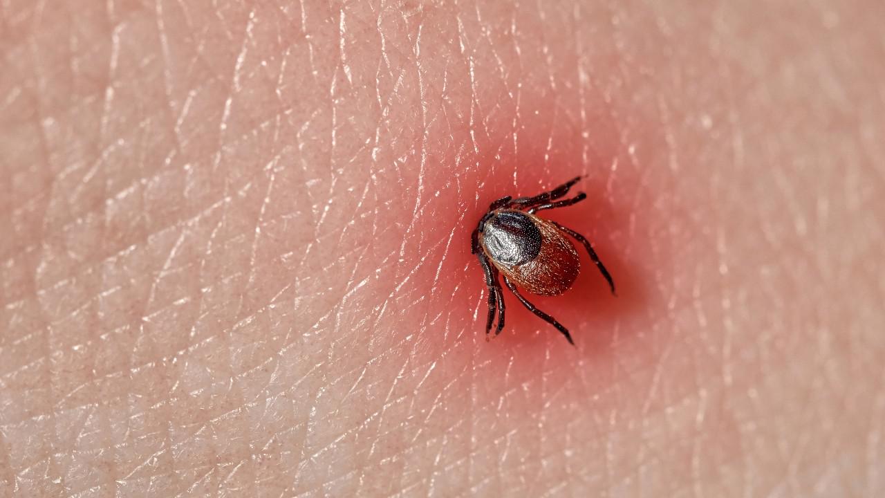 El Lyme Desembarc En Argentina Qu Es Y Cu Les Son Los S Ntomas