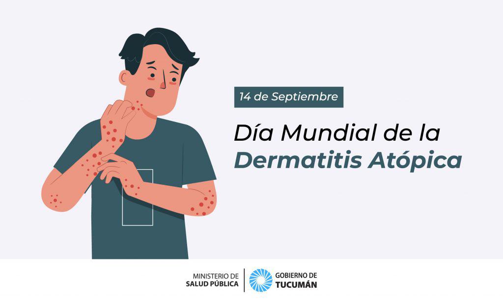dermatitis-atopica_p-1024x614