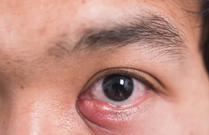 730x473_251107100903_81982